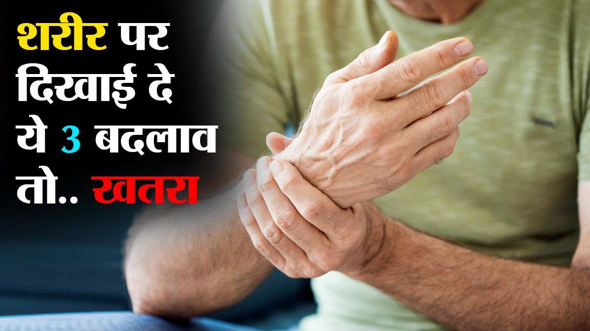 Symptoms Of Bad Cholesterol On Body क ल स ट र ल बढ गय ह क स पहच न Thehealthsite Com ह द