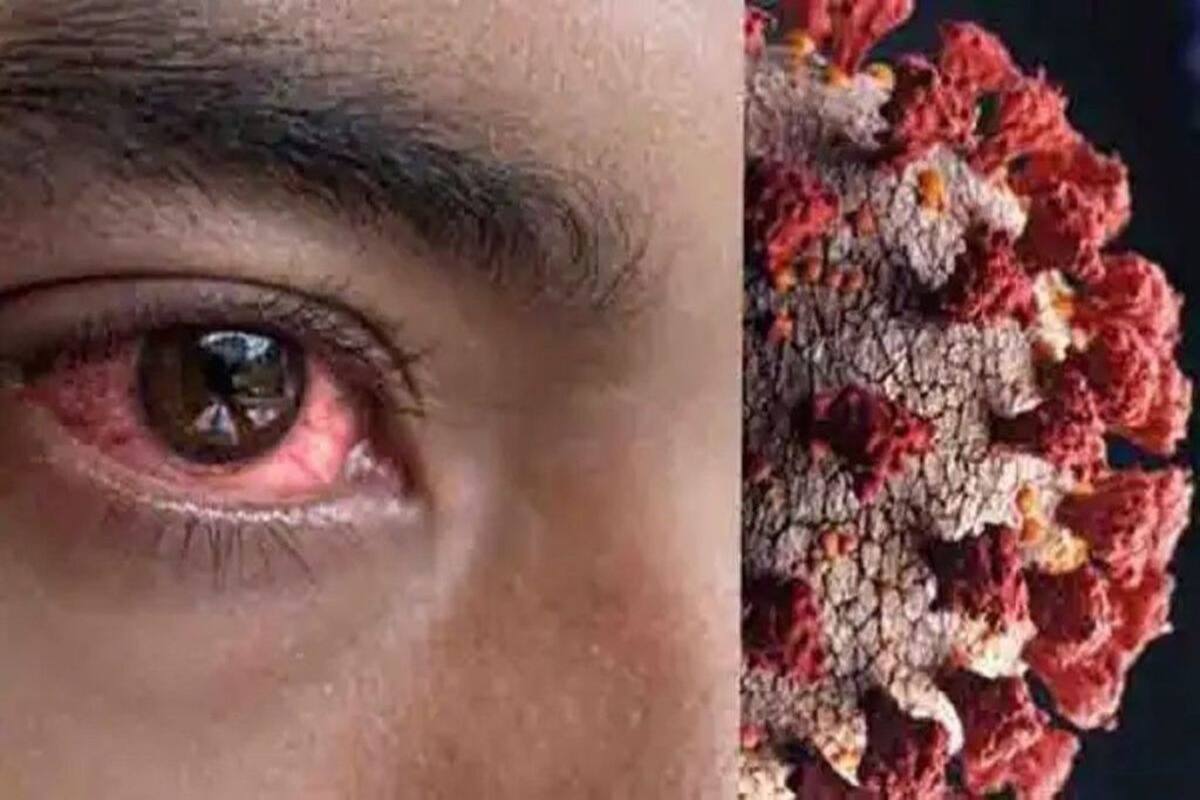 Symptoms Of Black Fungus In Hindi क य ह ब ल क फ गस य म य करम इक स स क लक षण क रण और इल ज Thehealthsite Com ह द Symptoms Of Black Fungus In Hindi क य ह ब ल क फ गस य म य करम इक स स क लक षण क रण और इल ज Thehealthsite Com ह द
