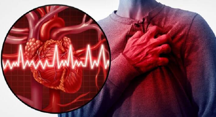 Myocardial Infarction: All You Need To Know About This Heart Disease