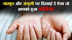 Covid19 and Skin Infection In Hindi : नाखून और पैर की उंगलियों में होने वाले ये बदलाव हैं आपको हो चुका है Covid