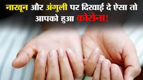 Covid19 and Skin Infection In Hindi : नाखून और पैर की उंगलियों में होने वाले ये बदलाव हैं आपको हो चुका है Covid