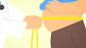 Being Obese Puts You At A Higher Risk Of Developing Gallstones; Here's How To Shed The Kilos