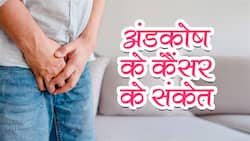 पुरुषों में टेस्टिकुलर कैंसर के लक्षण हैं स्क्रूटम में सिकुड़न और दर्द, 80% पुरुषों को लास्‍ट स्‍टेज में चलता है पता