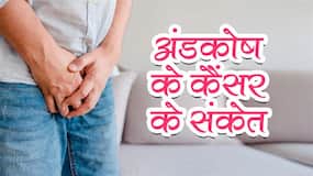 पुरुषों में टेस्टिकुलर कैंसर के लक्षण हैं स्क्रूटम में सिकुड़न और दर्द, 80% पुरुषों को लास्‍ट स्‍टेज में चलता है पता