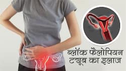 कैसे होता है ​ब्‍लॉक फैलोपियन ट्यूब का इलाज और इसमें कितना खर्चा आता है? जानिए डिटेल में