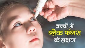 Black Fungus in Children: छोटे बच्‍चों में इस तरह दिख रहे हैं ब्‍लैक फंगस के लक्षण