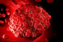 Why Do Some COVID-19 Patients Develop Life-Threatening Blood Clots? Scientists Explain