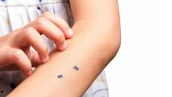 Causes of Mosquito Bites: कुछ लोगों को इन 5 कारणों से मच्छर काटते हैं ज्यादा, जानकर हो जाएंगे हैरान