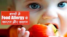 Food Allergies in Kids: बच्चों में फूड एलर्जी के 10 लक्षण, कहीं आपके बच्चे को तो नहीं हैं ये समस्याएं.