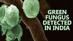 Green Fungus Detected In COVID-19 Recovered Patients Can Severely Damage Lungs, Blood Cells: Early Symptoms To Know Green Fungus Detected In COVID-19 Recovered Patients Can Severely Damage Lungs, Blood Cells: Early Symptoms To Know