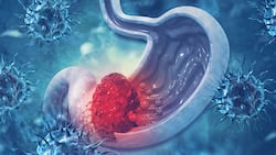 Stomach Cancer Awareness Month: How To Minimize The Risk Of Gastric Cancer?