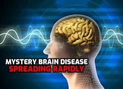 Deadly Rare Brain Disease Spreading Rapidly, Leaving Patients ‘Seeing Death' And 'Hallucinating’