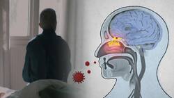 COVID-19 Can Severely Damage Your Brain, Cause Guillain-Barre Syndrome: Top 5 Symptoms To Look Out For