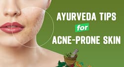 Ayurveda tips for acne-prone skin: Home remedies you should avoid