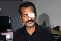 1.5 करोड़ रुपए में हुआ ब्‍लैक फंगस का इलाज, फिर भी गवांनी पड़ी एक आंख