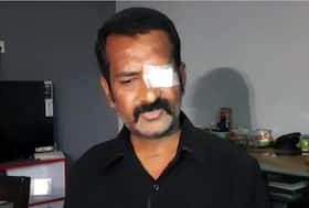 1.5 करोड़ रुपए में हुआ ब्‍लैक फंगस का इलाज, फिर भी गवांनी पड़ी एक आंख
