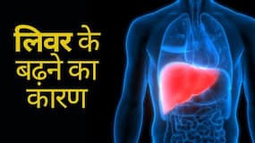 लिवर के बढ़ जाने का कारण और उपचार लिवर के बढ़ जाने का कारण और उपचार