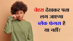 Signs of black fungus on Face in hindi : चेहरा देखकर पता चल जाएगा ब्लैक फंगस है या नहीं!