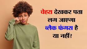 Signs of black fungus on Face in hindi : चेहरा देखकर पता चल जाएगा ब्लैक फंगस है या नहीं!