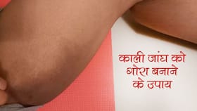 जांघ के ऊपर की स्किन हो गई काली-काली? ये घरेलू नुस्खे आपकी काली स्किन को बनाएंगे वापस गोरा