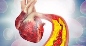Stiffness Of Arteries Could Indicate Risk Of Covid-19 Death In Hospitalised Patients