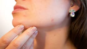 चेहरे पर घरेलू नुस्खे आजमाने के साइड एफेक्ट्स