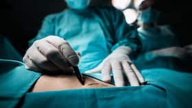 Smoother Silicone Breast Implants Lessen Intensity Of Inflammation And Immune System Reactions