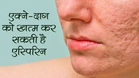 एक्ने और दाग-धब्बों को दूर करने में फायदेमंद है एस्पिरिन? जानें कितनी कारगर है इन दो समस्याओं में ये एक गोली