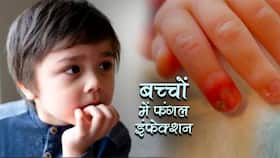 Fungul Infection In Kids: 5 साल से छोटे बच्‍चों में नाखूनों से होती है फंगल इंफेक्‍शन की शुरुआत, पेरेंट्स पहले से ही कर लें ये तैयारी