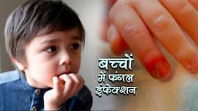 Fungul Infection In Kids: 5 साल से छोटे बच्‍चों में नाखूनों से होती है फंगल इंफेक्‍शन की शुरुआत, पेरेंट्स पहले से ही कर लें ये तैयारी