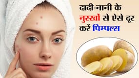 Home Remedies For Pimples: पिम्पल से भर जाता है बार-बार चेहरा, तो लगाएं आलू के रस बने ये फेस पैक, डार्क स्पॉट्स भी होंगे कम