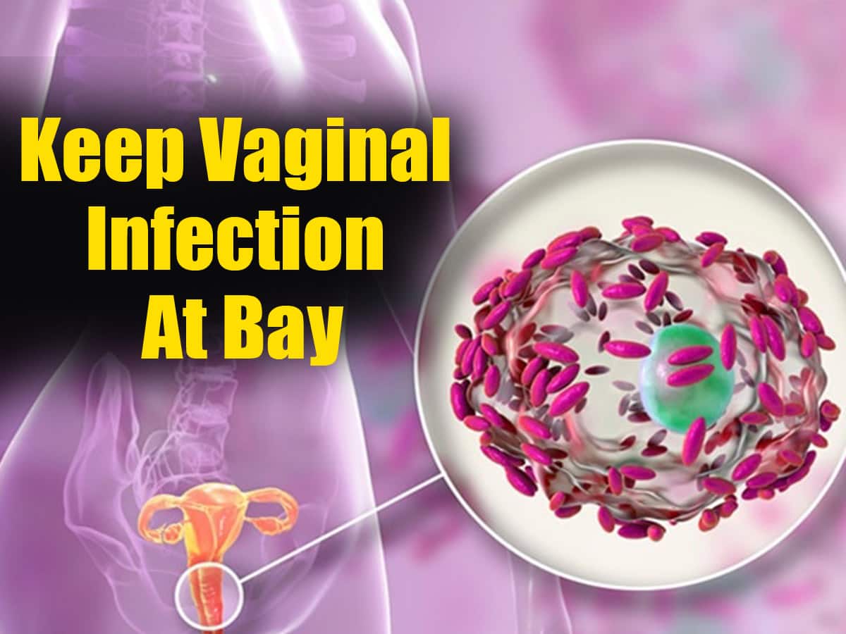 Vaginal Yeast Infection 5 Easy Home Remedies To Cure This Condition