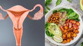 PCOS में किस तरह का आहार है फायदेमंद और किससे करें परहेज