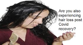 Hair Loss Post Covid-19 Is Usually Temporary: When To Seek Medical Intervention Hair Loss Post Covid-19 Is Usually Temporary: When To Seek Medical Intervention