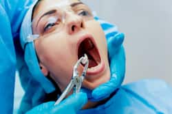 Myths About Wisdom Teeth: Third Molar Extraction Can Actually Improve Your Taste Function
