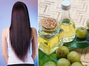 बालों के लिए 'सुपरफूड' है आंवले का तेल, जानिए घर पर Amla Hair Oil बनाने और इस्तेमाल करने का तरीका