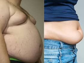 Body Fat: 4 तरह के होते हैं बॉडी फैट, जानिए शरीर में कौन सी चर्बी आपके लिए है खतरनाक