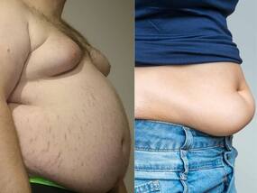 Body Fat: 4 तरह के होते हैं बॉडी फैट, जानिए शरीर में कौन सी चर्बी आपके लिए है खतरनाक