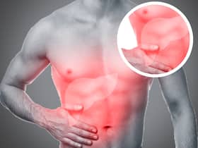 Include Good Cholesterol In Your Diet; It May Help Protect Your Liver Include Good Cholesterol In Your Diet; It May Help Protect Your Liver