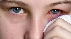 Conjunctivitis Among Children: Symptoms, Precautions And Tips For Parents