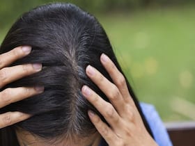 जड़ों से सफेद होते बाल को छुपाने के उपाय