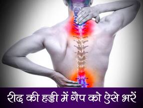 रीढ की हड्डी में आए गैप को कैसे कम करें? जानें आयुर्वेदिक तरीके से गैप को कम करने का तरीका