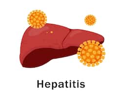 Asymptotic Nature Of Hepatitis B And C: Know The Importance Of Early Detection