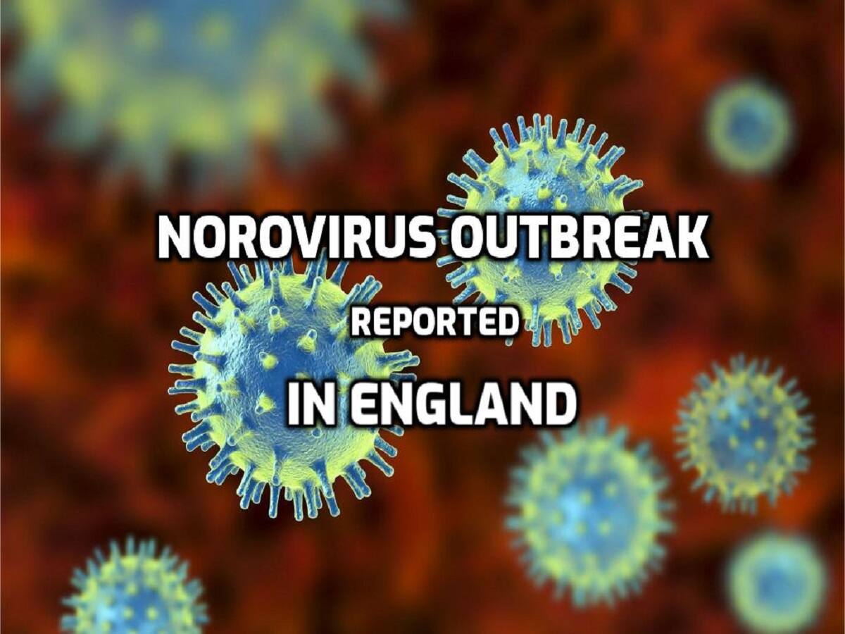 Norovirus Outbreak In England Know All About The Highly Infectious Virus Thehealthsite Com