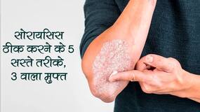 5 से 10 रुपये में मिलने वाली ये सस्ती चीजें सोरायसिस जैसी बीमारी को कर सकती हैं ठीक, तीसरी चीज मिलती है बिल्कुल मुफ्त 5 से 10 रुपये में मिलने वाली ये सस्ती चीजें सोरायसिस जैसी बीमारी को कर सकती हैं ठीक, तीसरी चीज मिलती है बिल्कुल मुफ्त