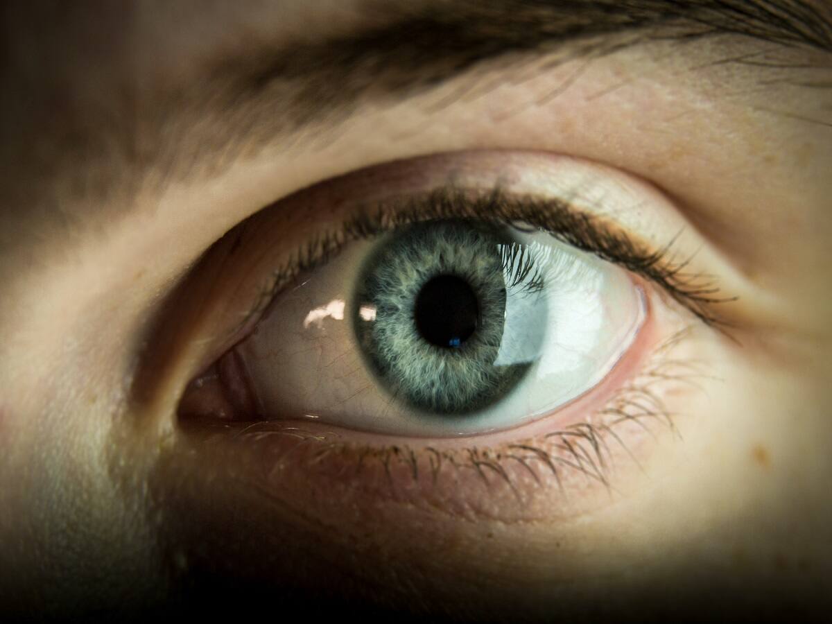 Signs Of High Cholesterol That Show Up In Your Eyes