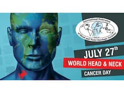 सिर और गर्दन के कैंसर के शुरुआती लक्षण, मुख्य कारण, इलाज