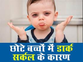 Home Remedies For Dark Circles in Children: छोटे बच्‍चों को क्‍यों होती है डार्क सर्कल की समस्‍या? जानिए कारण और घरेलू उपचार