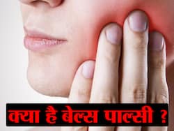 Bell's Palsy Post Covid-19 Recovery: कोरोना रिकवरी के बाद मुंबई में पाए गए बेल्स पॉल्सी के मामले, यहां पढ़ें क्या है यह बीमारी और इसके लक्षण