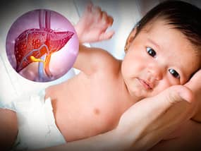 Hepatitis In Children: Abdominal Swelling And Other Warning Symptoms You Should Know
